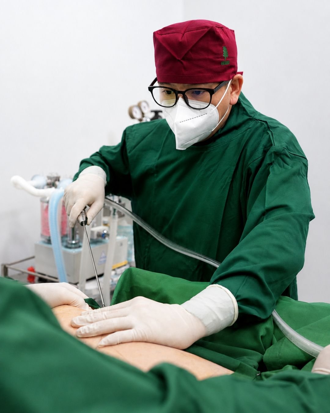 Dokter bedah melakukan tindakan sedot lemak (liposuction) di The Mercy Clinic